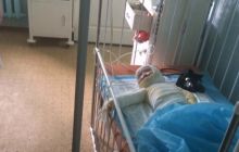 В Одесі померла дівчинка, яку батьки облили окропом і два тижні "лікували" вдома (фото)
