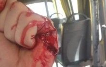 "Льготы не клянчить": в Киеве водитель маршрутки напал с ножом на АТОшника (фото)