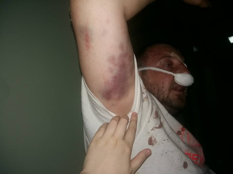 Активисты сообщили о жестоком избиении полицией добровольца АТО (фото, видео) Активисты сообщили о жестоком избиении полицией добровольца АТО (фото, видео)