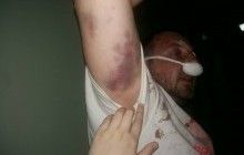 Активісти повідомили про жорстоке побиття поліцією добровольця АТО (фото, відео)