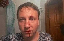 У Чорноморську на Одещині побили депутата міськради
