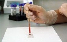 Тест, що виявляє рак за аналізом крові, підтвердив свою високу ефективність