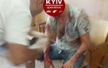 У Києві в ЖЕКу невідомі розстріляли чоловіка, відібравши у нього 200 тисяч гривень (фото, відео)