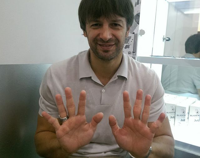 Олександр Шовковський продемонстрував кисті рук / football24.ua Олександр Шовковський продемонстрував кисті рук / football24.ua