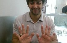 Шовковський показав свої руки без рукавичок: У мене кожен палець був пошкоджений в тій чи іншій мірі