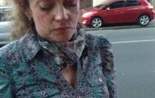 В центре Одессы злоумышленник избил известную активистку