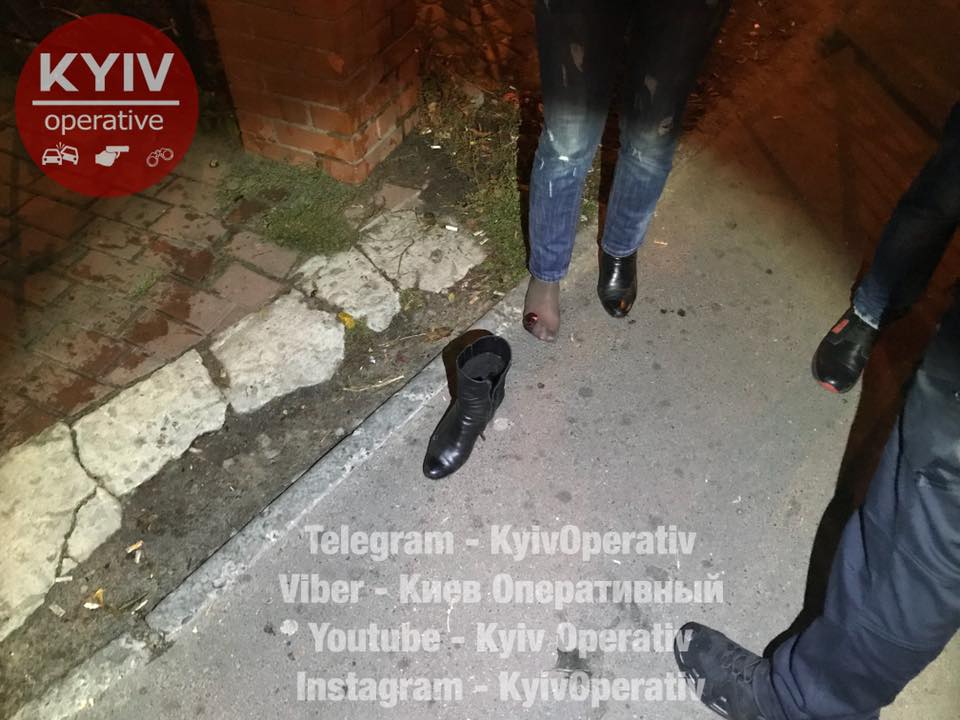 У женщины незначительные ранения ноги / фото facebook/KyivOperativ У женщины незначительные ранения ноги / фото facebook/KyivOperativ