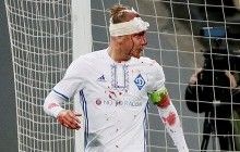 Гравцеві "Динамо" Віді наклали 10 швів, але струсу мозку немає, можливість участі в матчі з "Шахтарем" - 50 на 50