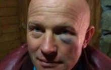 Побиття Лозового: ветеран АТО - учасник інциденту розповів свою версію (фото)