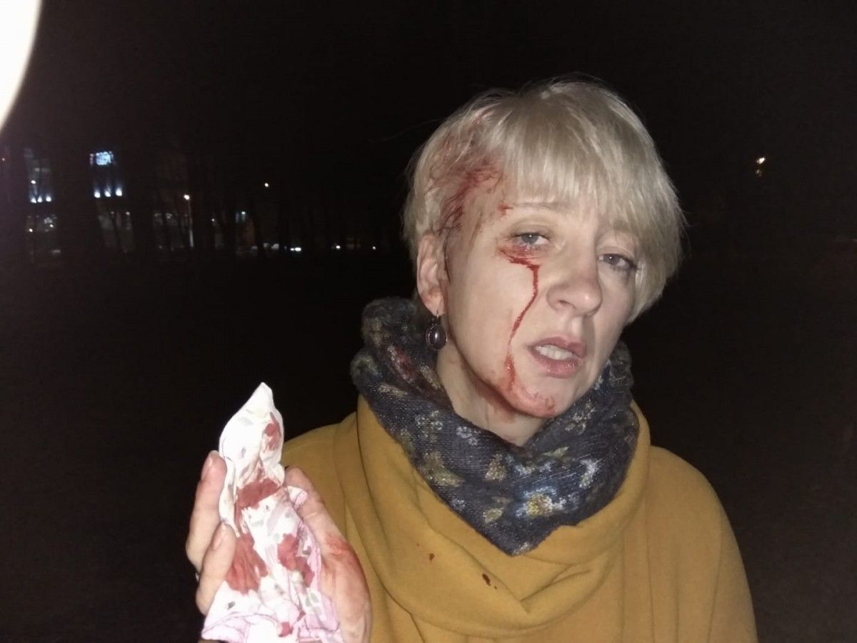 Після нападу Гольник і її чоловіка забезпечили охороною / фото Лариса Гольник, Facebook Після нападу Гольник і її чоловіка забезпечили охороною / фото Лариса Гольник, Facebook