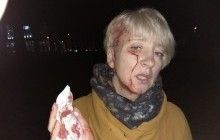 В прокуратуре рассказали о версиях нападения на судью Гольник в Полтаве