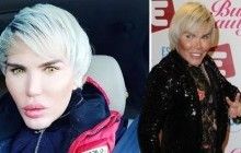 Після 50 пластичних операцій бразильський кен зізнався, що не схожий на бойфренда барбі