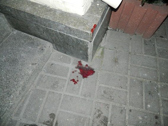За нападение на прохожего задержали двух парней / фото kyiv.npu.gov.ua За нападение на прохожего задержали двух парней / фото kyiv.npu.gov.ua