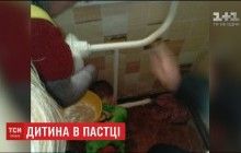 На Дніпропетровщині надзвичайники врятували хлопчика, який застряг у батареї (відео)
