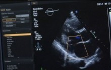 У Великій Британії розроблено метод діагностики, що за лічені хвилини виявляє хвороби серця (відео)