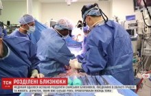 У США проведено операцію по розділенню сіамських близнюків, які зрослися головами (відео)