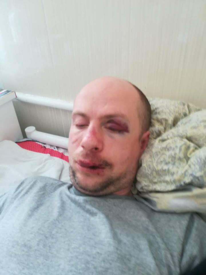 Бійця АТО побили і пограбували / фото facebook.com/svetlana.shepi Бійця АТО побили і пограбували / фото facebook.com/svetlana.shepi