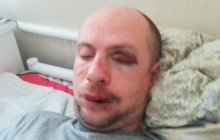 "Дело могут "замять": жена рассказала о жестоком избиении мужа-АТОшника под Киевом (фото)