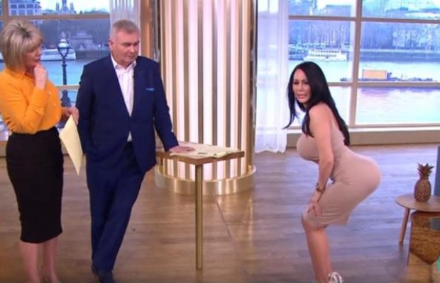 Хотела переплюнуть Кардашьян: британка накачала себе огромные ягодицы и теперь с трудом ходит (видео)