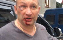 "Укроп и фашист": появились подробности жестокого избиения украинца в Крыму (фото, видео)