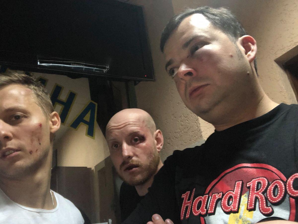 У ЗМІ з'явилася нова версія інциденту з побиттям сина Шуфрича та його друзів / фото facebook.com/Пресс-служба Нестора Шуфрича У ЗМІ з'явилася нова версія інциденту з побиттям сина Шуфрича та його друзів / фото facebook.com/Пресс-служба Нестора Шуфрича