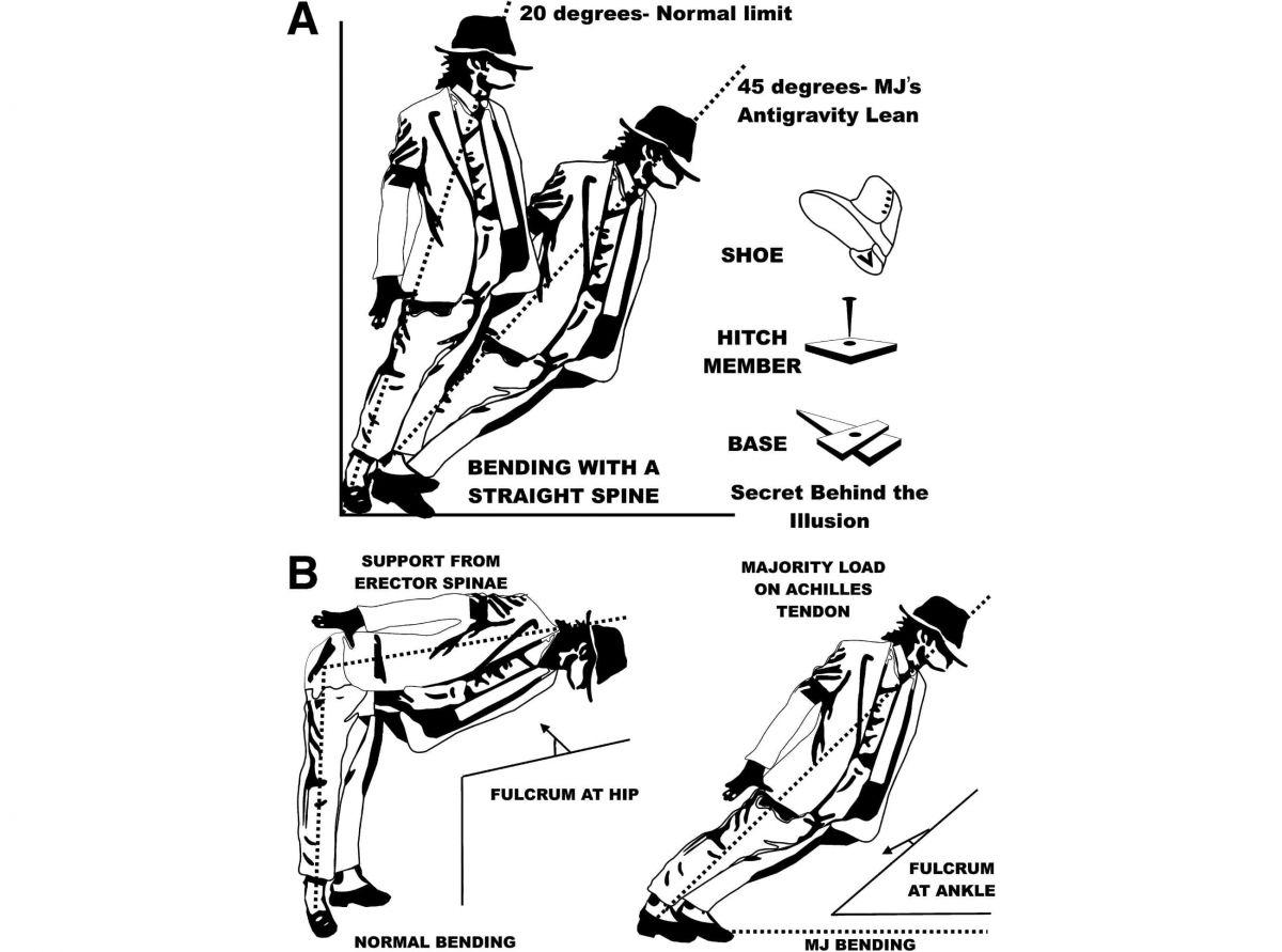 Механизм наклона / © Journal of Neurosurgery: Spine Механизм наклона / © Journal of Neurosurgery: Spine
