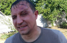 У Кривому Розі невідомі напали на депутата міськради, оголошено план "Перехоплення" (фото)