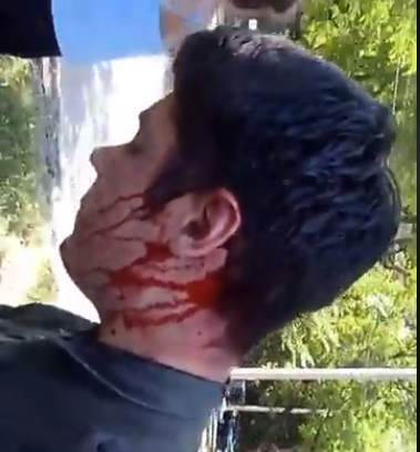 Главе местного Автомайдана Устименко нанесли черепно-мозговую травму, рану виска и бедра / скриншот