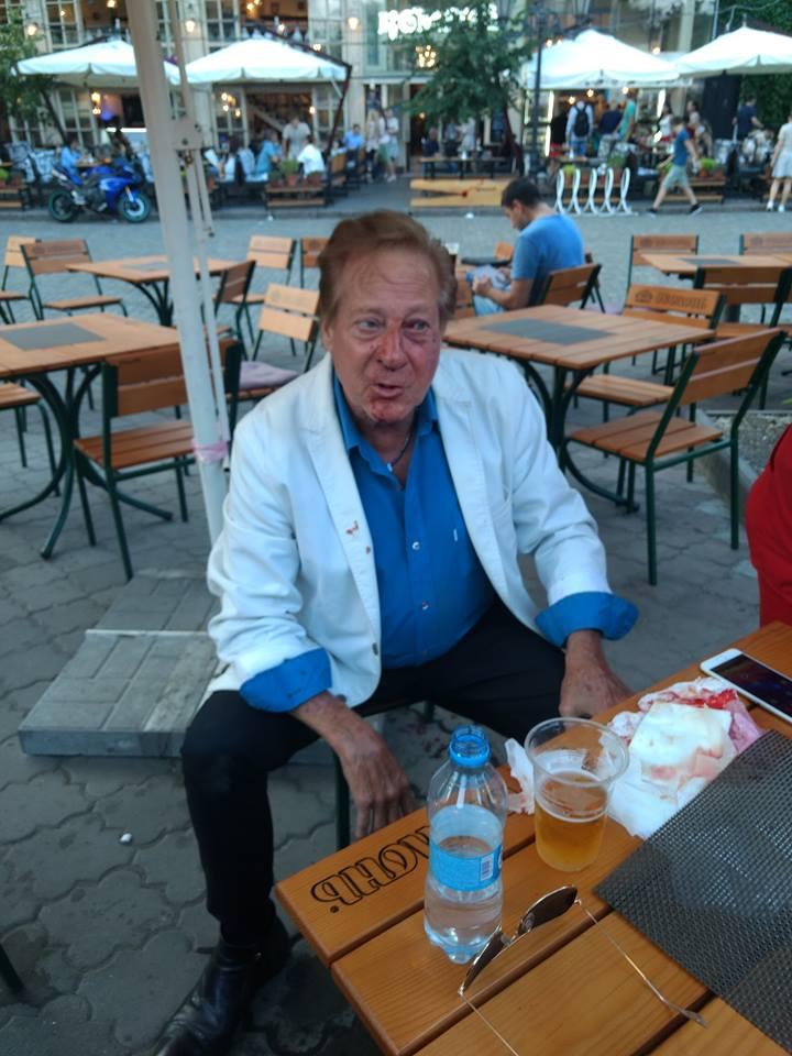 Білла Уоррена побили в центрі Одеси / фото facebook.com/Redaction.odessa Білла Уоррена побили в центрі Одеси / фото facebook.com/Redaction.odessa