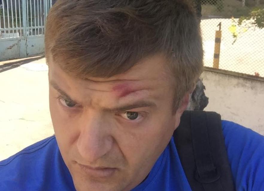 У Херсоні мовчазні бородані побили журналіста Сергія Нікітенка / Facebook - Сергій Нікітенко У Херсоні мовчазні бородані побили журналіста Сергія Нікітенка / Facebook - Сергій Нікітенко