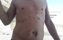 "Невозможно купаться": в сети показали новые фото из пляжа в Крыму