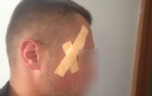 В Ривненской области в результате столкновения с янтарокопателями пострадали 8 полицейских