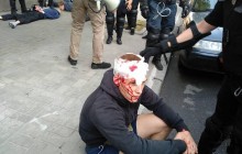 Націоналісти заявили про силовий розгін мітингу проти ЛГБТ-маршу у Києві – затримано близько 20 осіб (фото)