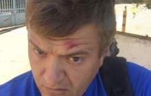 В Херсоне избили журналиста (фото)