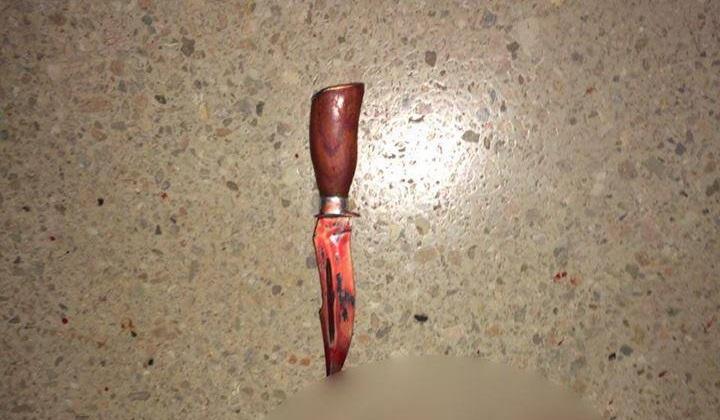 Чоловік вдарив себе ножем у груди / Фото facebook.com/volyntv