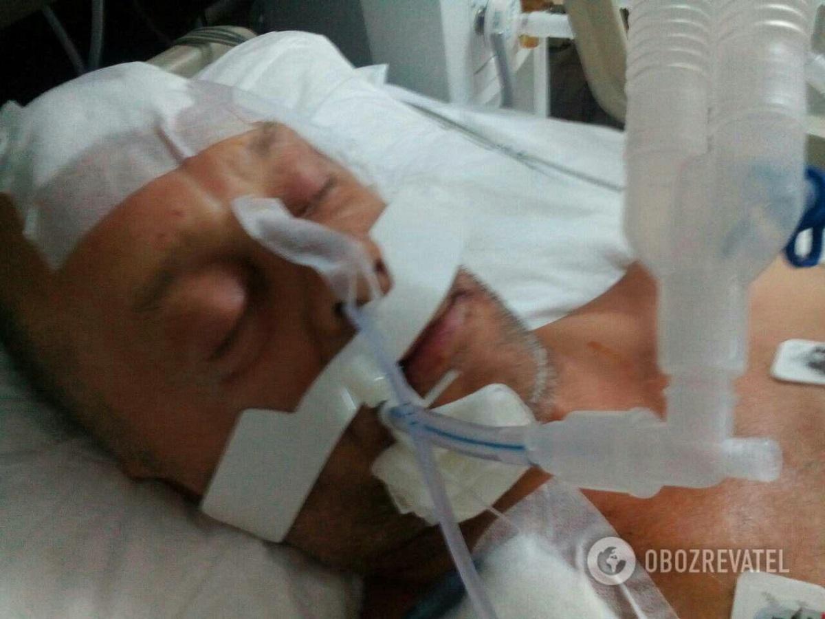 Избитый россиянином в Турции украинец умер / фото Обозреватель