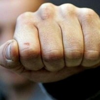 В Кривом Роге депутата избили трубой