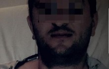 Опубликовано фото плененного ВСУ россиянина на Донбассе