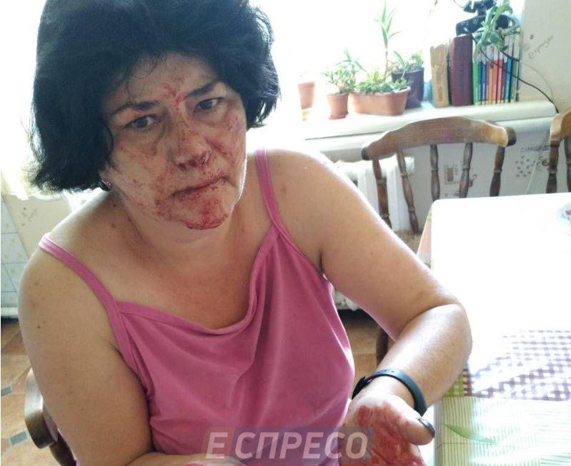 На Киевщине жестоко избили женщину / фото Эспресо