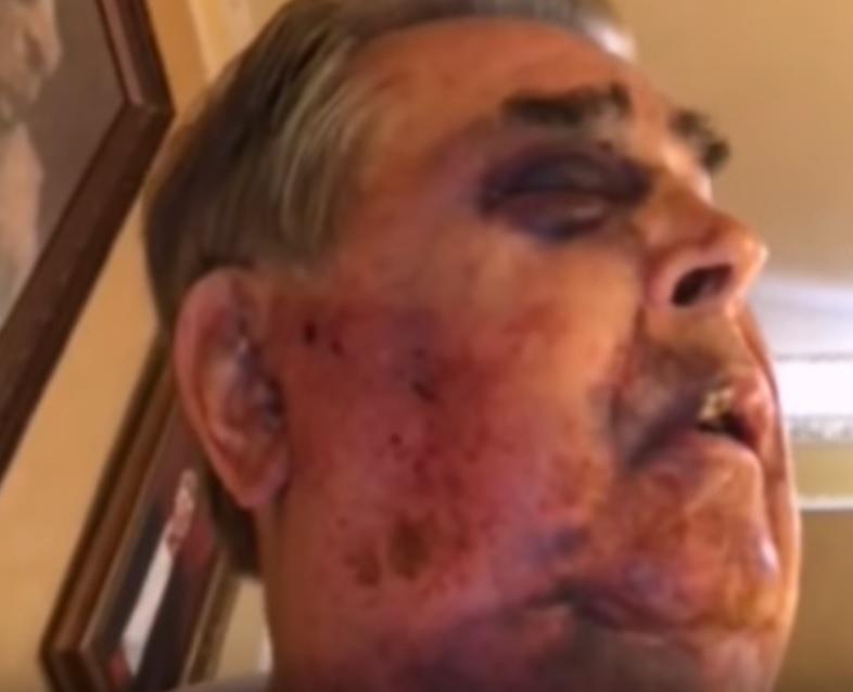 В Крыму избили бывшего нардепа и экс-премьера Крыма Франчука / Скриншот - Youtube - КИУ В Крыму избили бывшего нардепа и экс-премьера Крыма Франчука / Скриншот - Youtube - КИУ