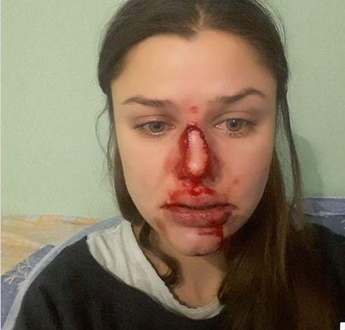 Шевцова написала про насильство у родині / Скріншот Шевцова написала про насильство у родині / Скріншот