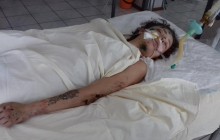 На Київщині лікарі просять допомогти опізнати дівчину з татуюванням, яка потрапила у ДТП (відео)