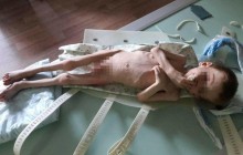 СМИ: на Кировоградщине родители морили голодом четырехлетнего сына, он весит всего 7 кг (фото)