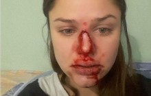 Київський психолог публічно заявила про звірства чоловіка (фото)