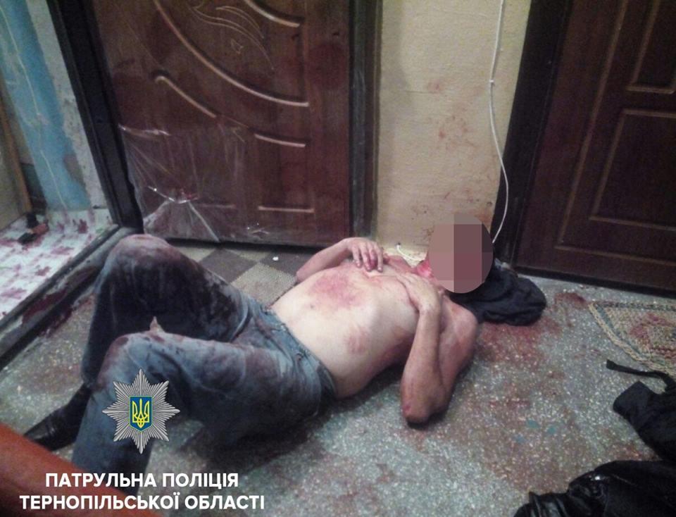 У Тернополі після бійки госпіталізували двох чоловіків, в одного з них виявили пістолет (Фото) У Тернополі після бійки госпіталізували двох чоловіків, в одного з них виявили пістолет (Фото)