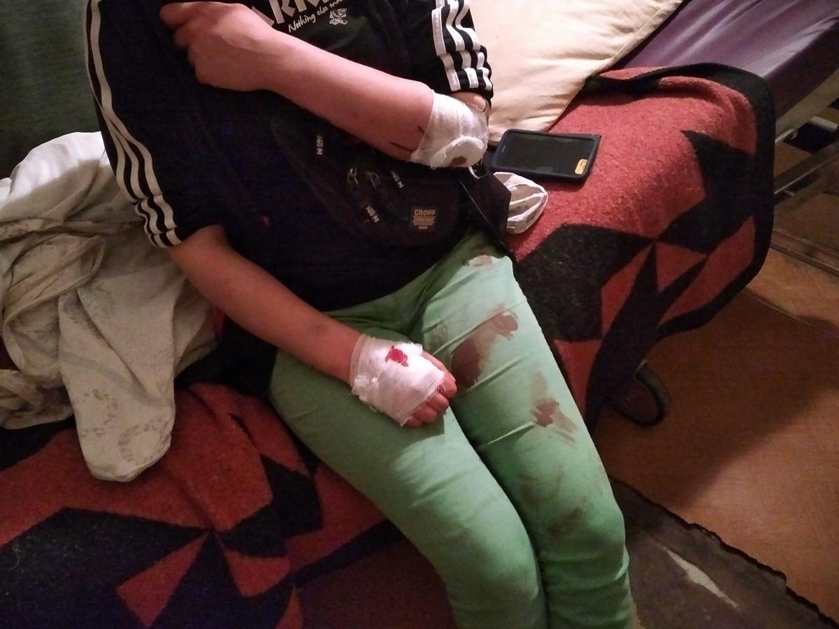 Речниця поліції Львівщини Світлана Добровольська підтвердила напад на людей / фото facebook.com/iryna.yuzyk Речниця поліції Львівщини Світлана Добровольська підтвердила напад на людей / фото facebook.com/iryna.yuzyk