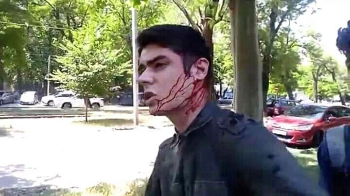 Суд арестовал подозреваемого в нападении на одесского активиста Устименко / фото Facebook Суд арестовал подозреваемого в нападении на одесского активиста Устименко / фото Facebook