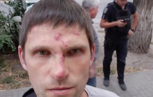В Днепре активиста избили за хорошее настроение (фото)