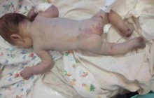 Помер малюк, підкинутий лікарям у коробці на Миколаївщині