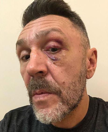 Сергея Шнурова якобы избили / фото instagram.com/shnurovs